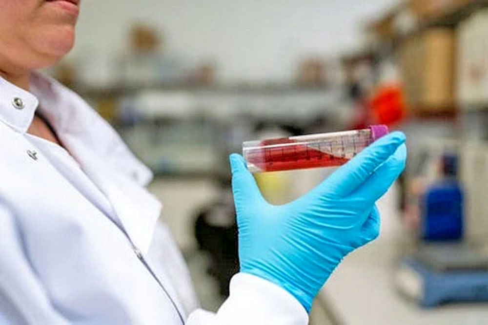 Vitamina D en la sangre es un indicador importante del estado de salud