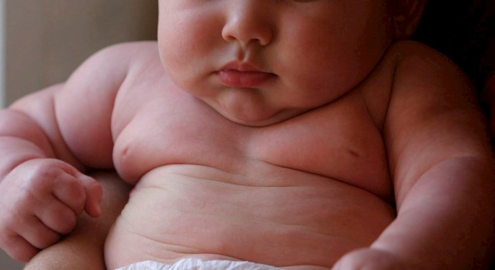 Acumulación de grasa corporal durante infancia afecta de por vida la salud