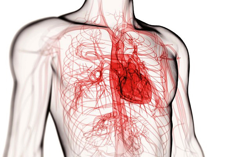 Niveles de calcio en arterias se asocia con factor de riesgo de enfermedad cardiaca