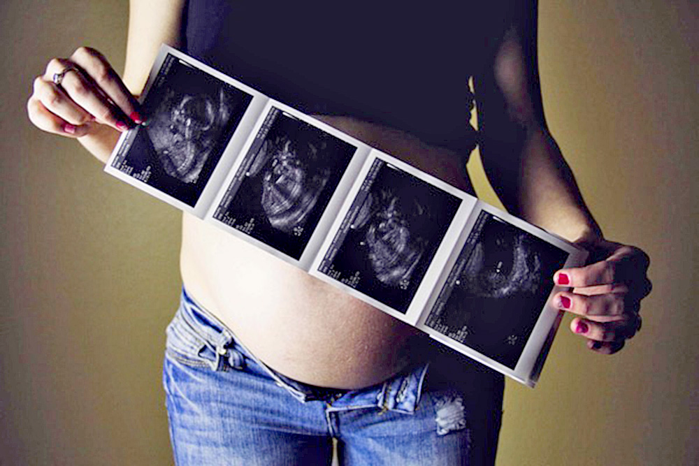 Estudio encuentra método para predecir el comienzo de labor de parto