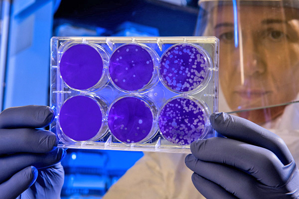 Esfuerzos internacionales utilizan avances tecnológicos contra la tuberculosis