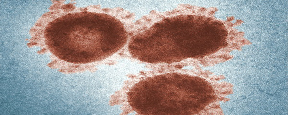 Lambda, la nueva variante de interés de Covid-19