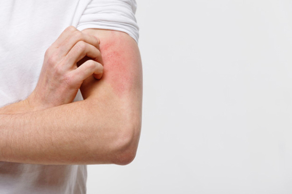 Dermatología puede mejorar la calidad de vida en personas con afecciones de la piel