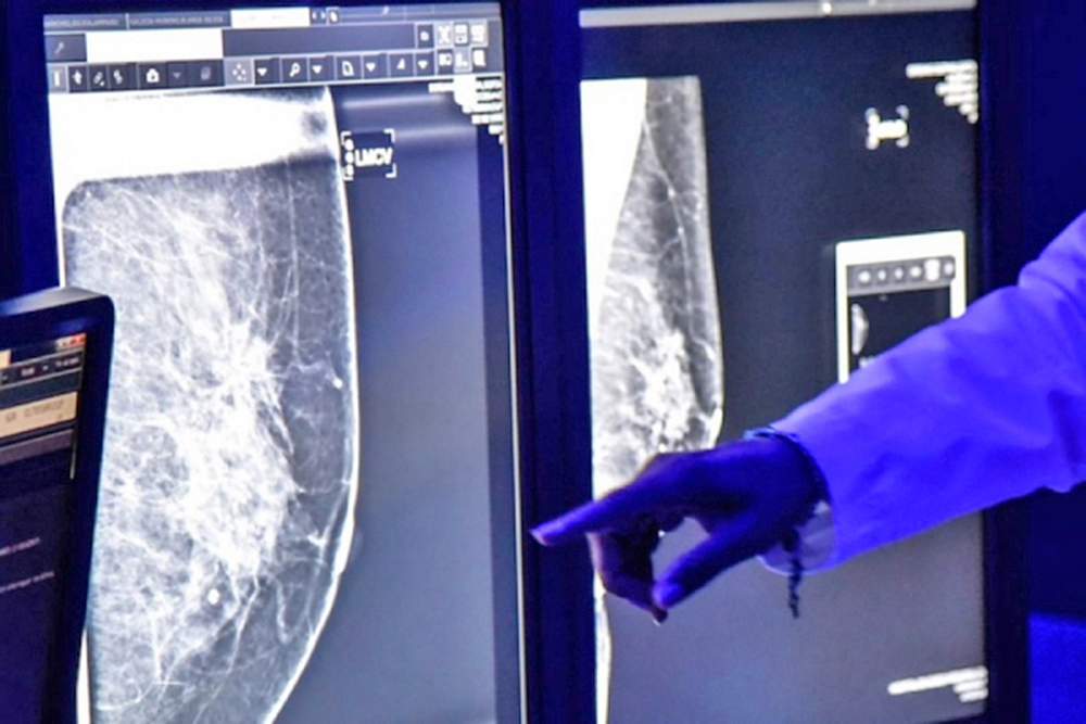 Deep learning podría predecir el riesgo de padecer cáncer de mama