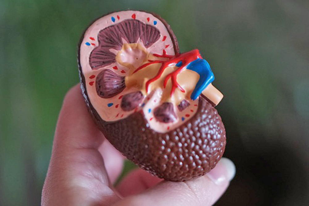 ¿Qué alimentos comer para evitar los cálculos renales?