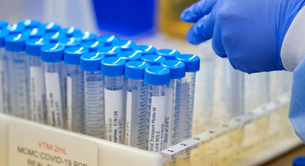 Condado Hidalgo revela 23,000 casos positivos de COVID no reportados en enero