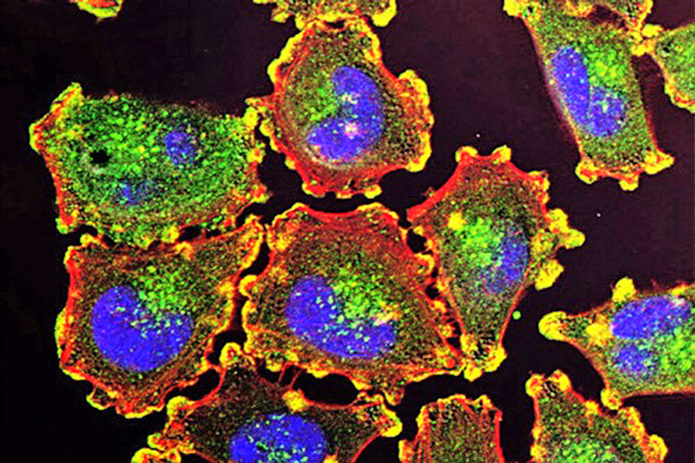 Gran parte de las investigaciones sobre el cáncer no son reproducibles revela estudio