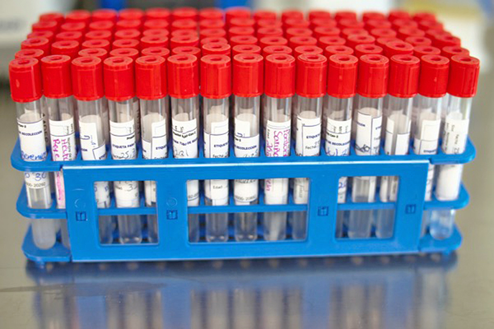 Células T del resfriado común podrían generar una respuesta inmune al SARS-CoV-2