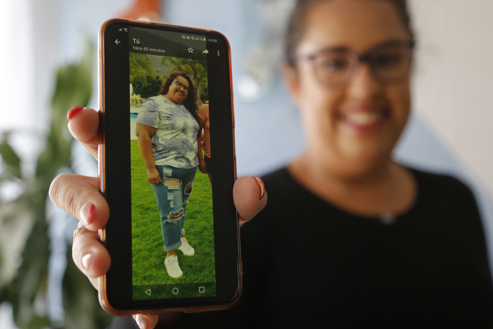 Cirugía de manga gástrica, al alza entre adultos y adolescentes