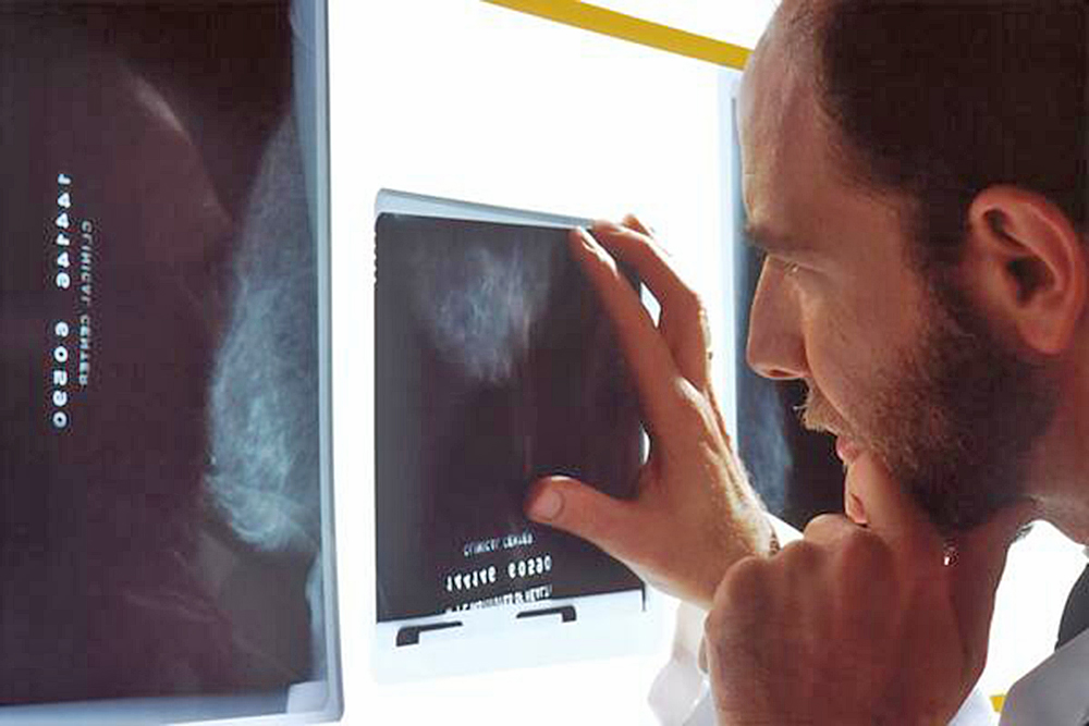 Detectar a tiempo el cáncer de colon puede marcar la diferencia en adultos jóvenes