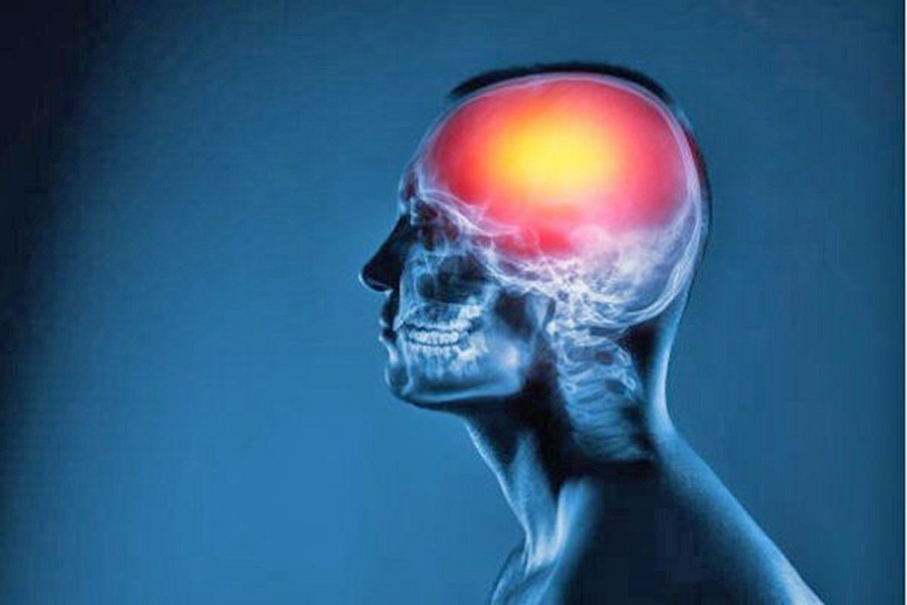 Conmociones cerebrales: ¿por qué la microbiota intestinal es clave para tratarlas?