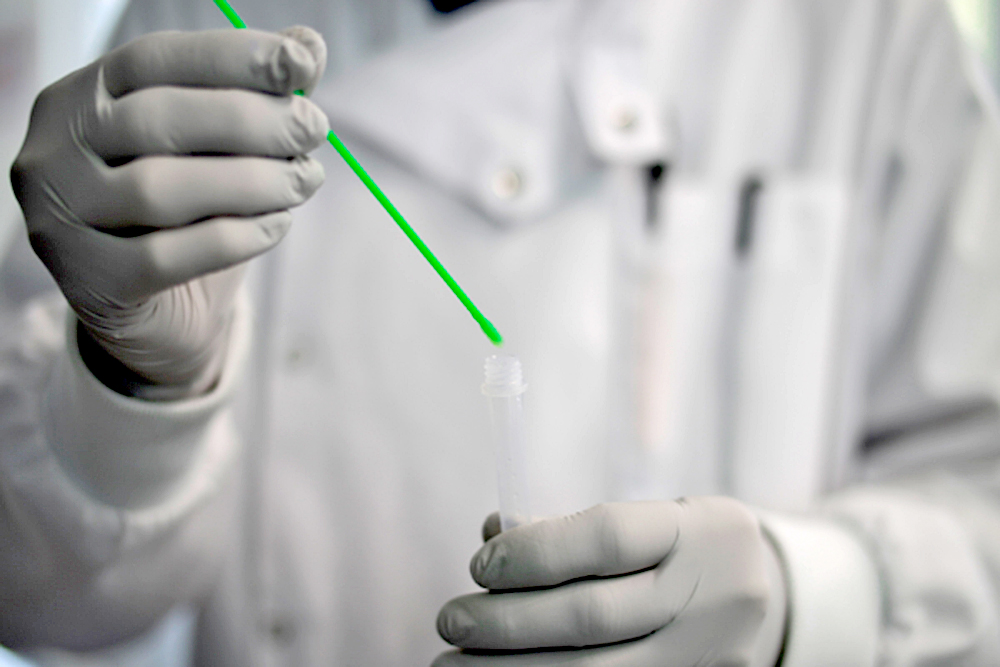 Nueva tecnología podría ser una solución para la vacuna contra el VIH