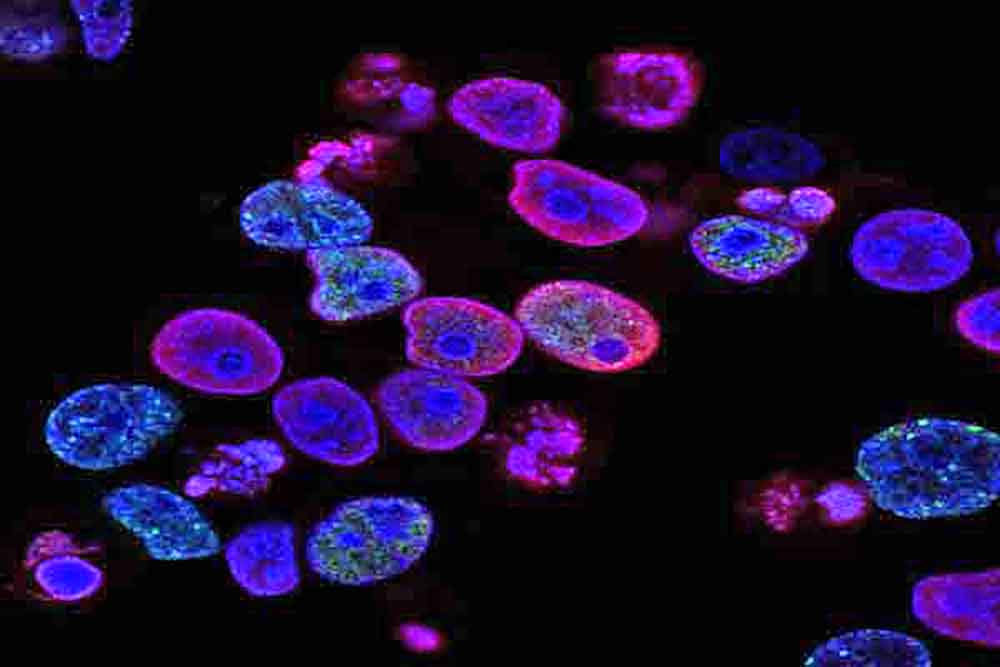 Científicos descubren que la migración celular estaría controlada por reloj molecular