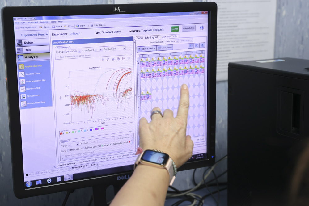 EE.UU. inicia pruebas para detección de viruela del mono
