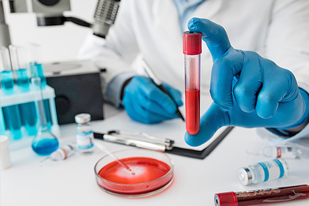 Identificación y tratamiento oportuno: pilar para tratar hemofilia adquirida