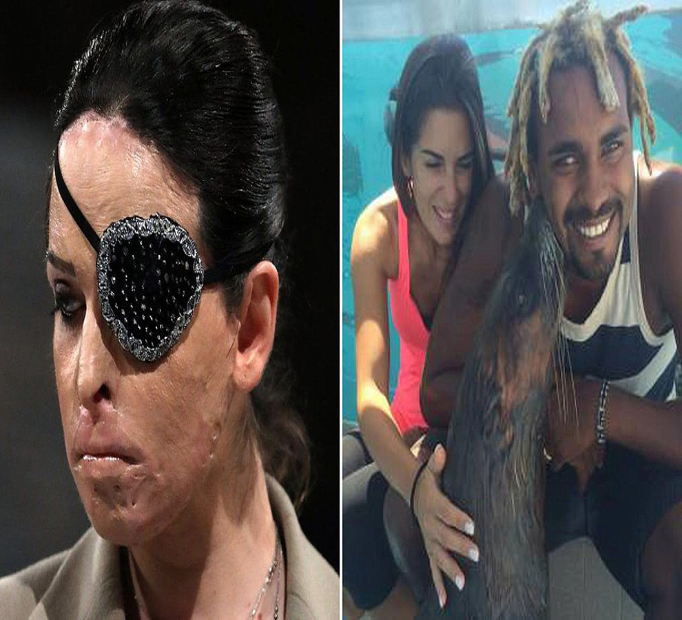 Gessica Notaro, la miss italiana que fue rociada con ácido por su ex novio