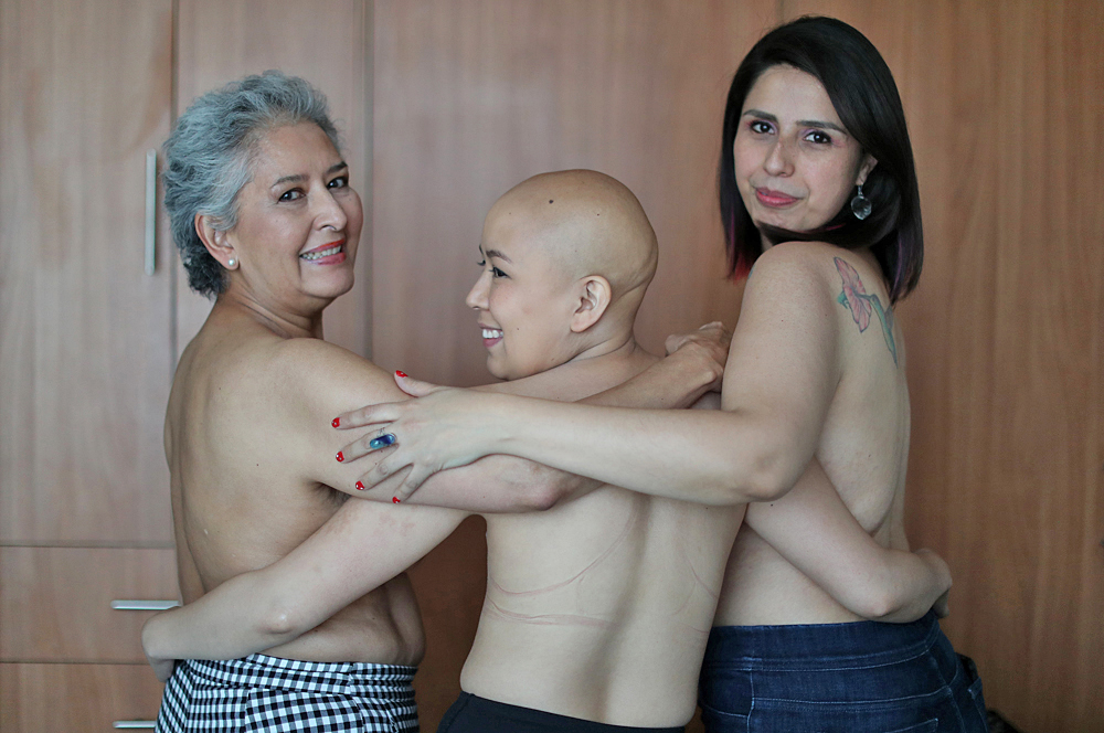 Cáncer de mama en tres generaciones, mucho más que un lazo rosa