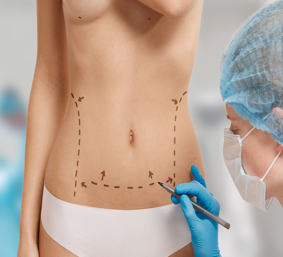 ¿Cuáles son las cirugías estéticas más frecuentes en México y el mundo?