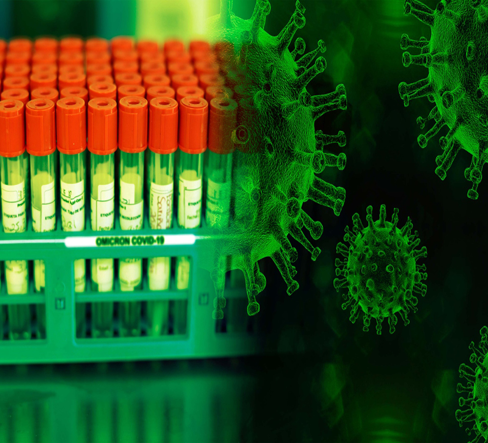 África podría tener un número mayor de muertes por Covid-19 del registrado: estudio