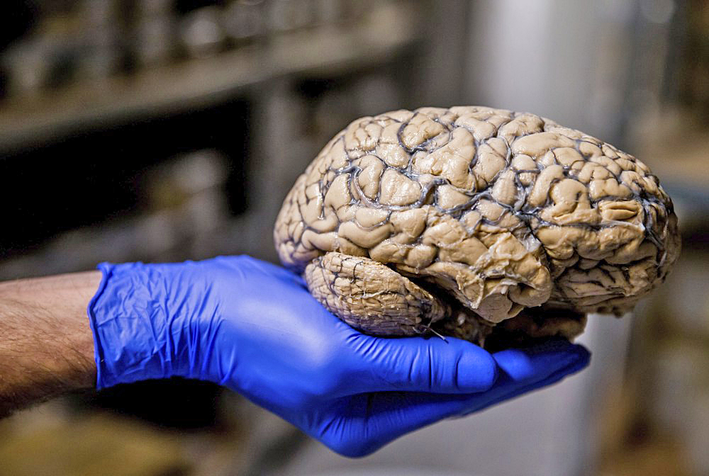 Estudio revela las bases neurológicas de la polarización política