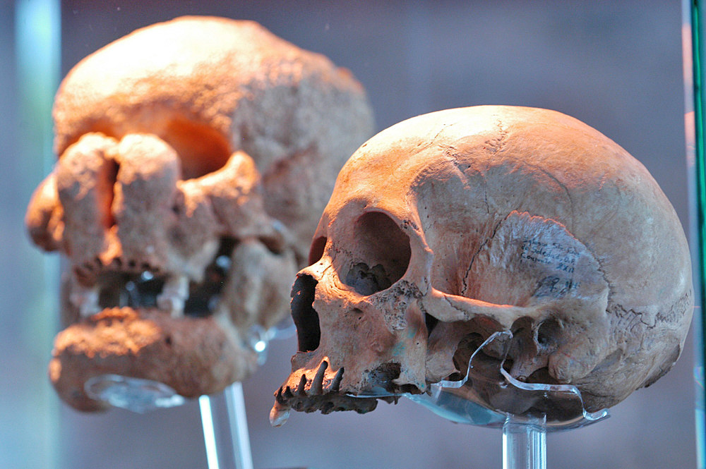 Científicos de Florida descubren nueva forma de tratar la osteoporosis