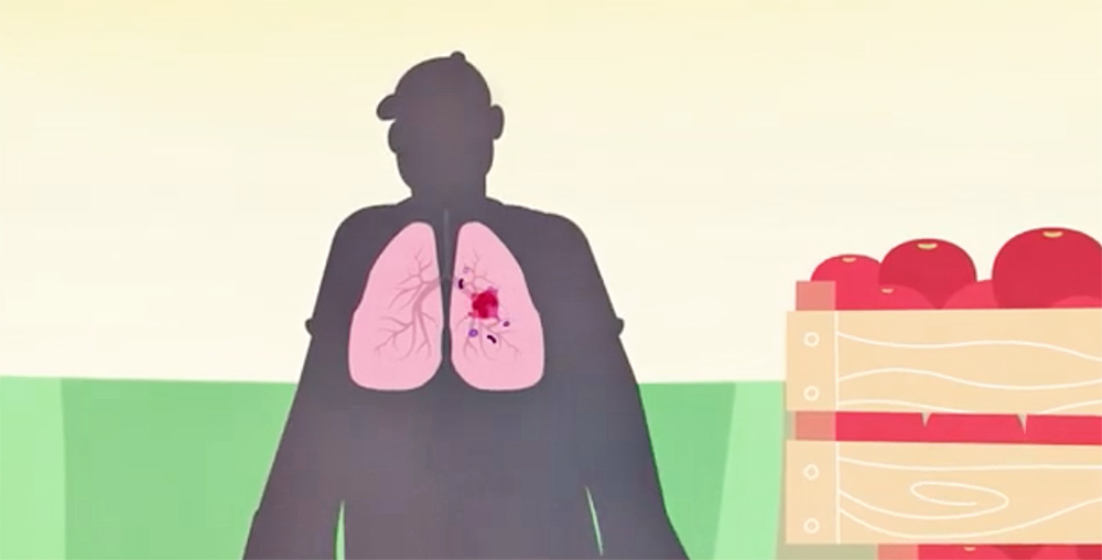 Defensores de los pacientes con cáncer apoyan ampliar acceso a  pruebas de biomarcadores