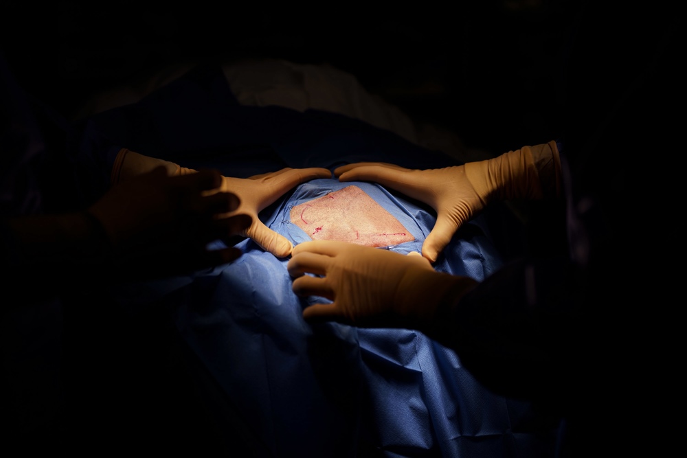 Emiten alerta por posibles casos de meningitis fúngica tras cirugías en Matamoros