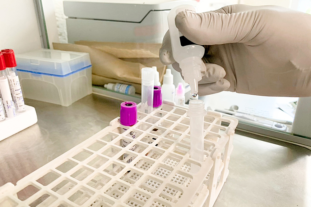 Impresoras de vacunas: innovación que podría cambiar la distribución de vacunas