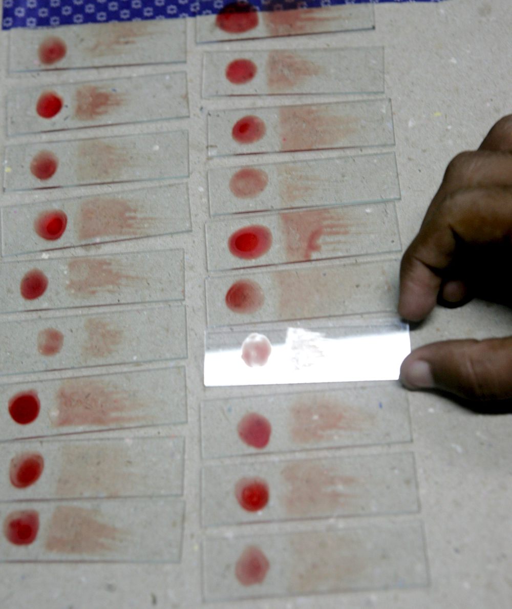 Científicos de Florida desarrollan un antibiótico natural para detener la malaria