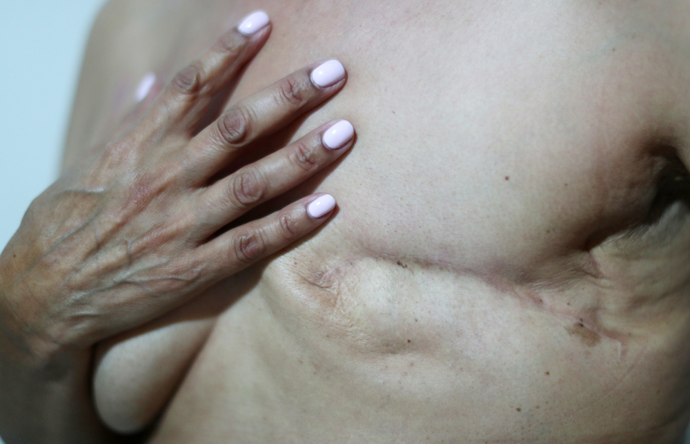 Un “caballo de Troya” farmacológico da una oportunidad al cáncer con alto nivel de HER2