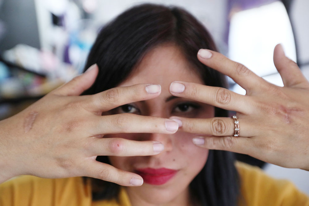 “Vivir sin miedo”, el reto de una víctima de intento de feminicidio en México