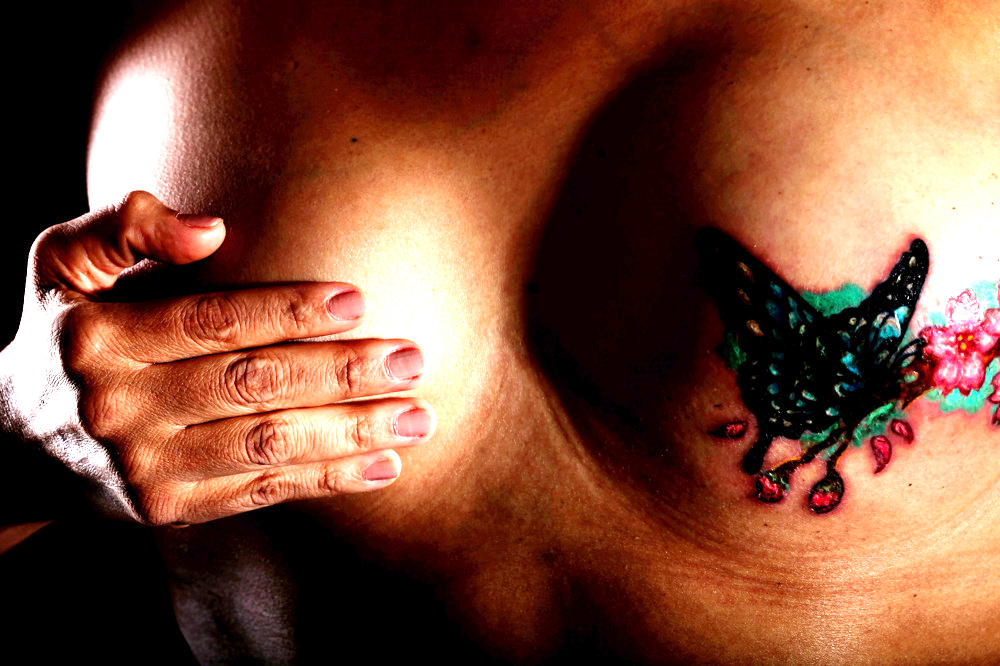 El apoyo emocional es vital para las pacientes que luchan contra el cáncer de mama