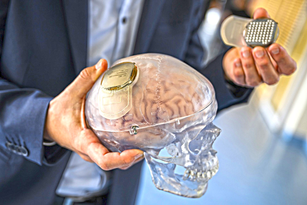 Científicos crean un “atlas” de células cerebrales que permitirá curar trastornos mentales