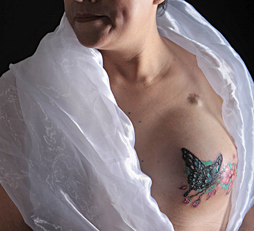 La mortalidad por cáncer de mama ha disminuido un 58 % en EEUU desde 1975