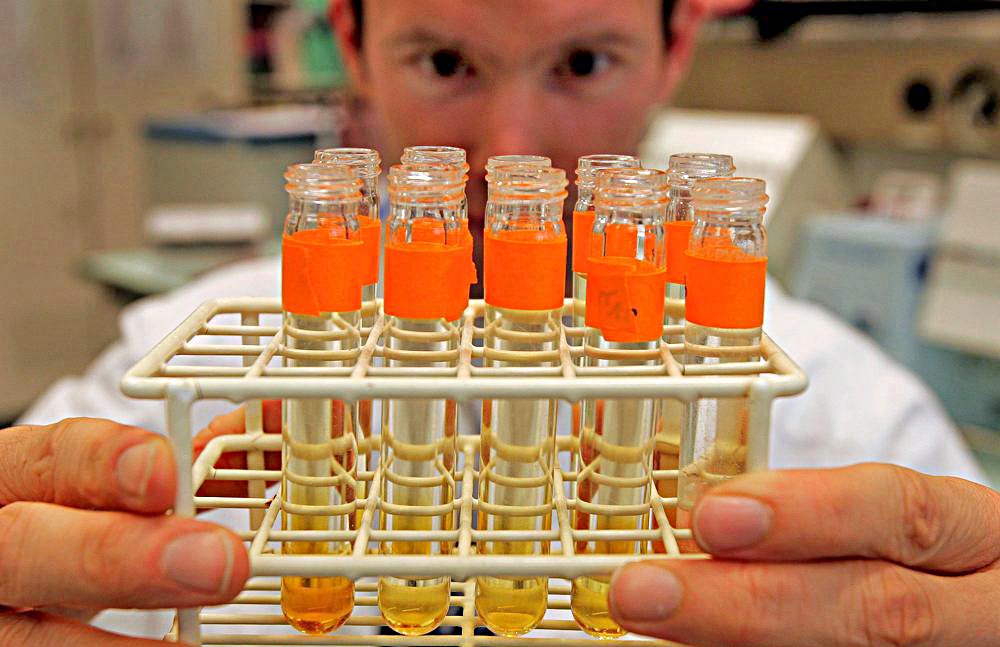 Tras siglos de misterio, investigadores de EE.UU. descubren por qué la orina es amarilla