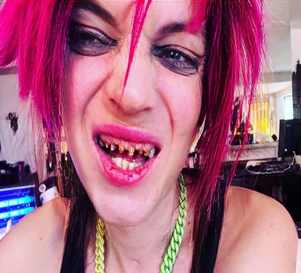 Hijo de Camilo Sesto: alarma su desmejorado aspecto y los problemas con su madre