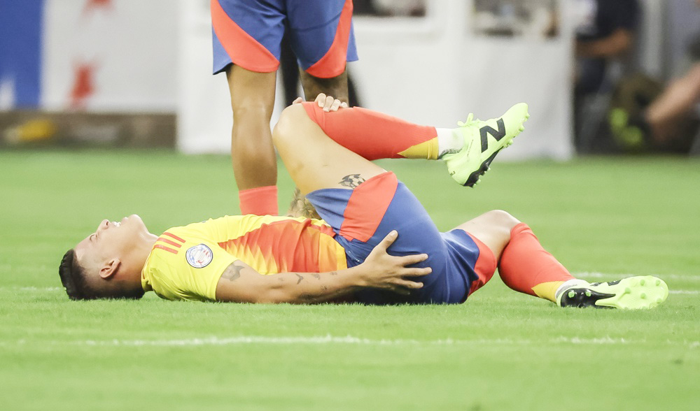 James dice que es mejor ganar y corregir cosas