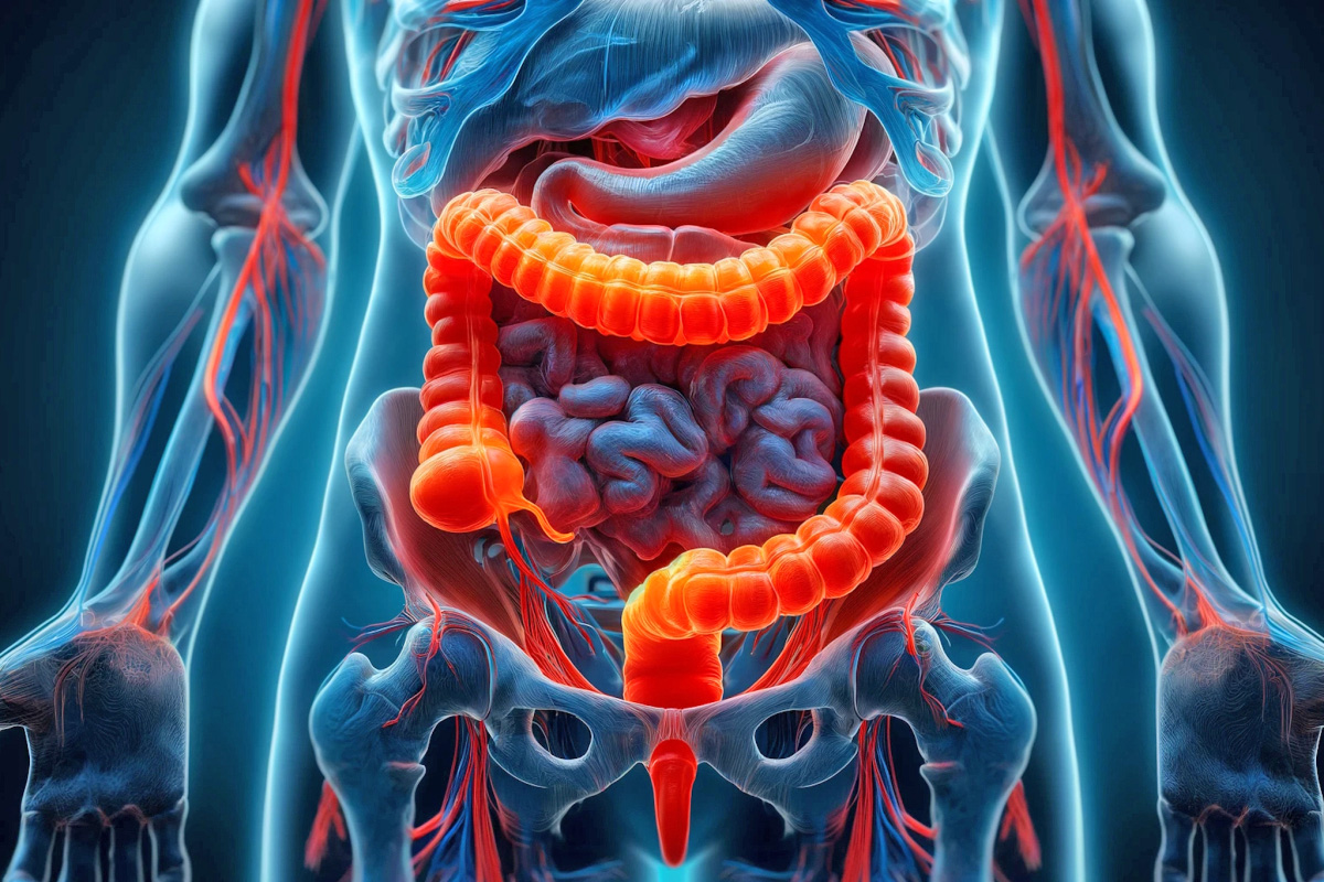 El reto global de salud por el aumento de cáncer colorrectal en menores de 50 años