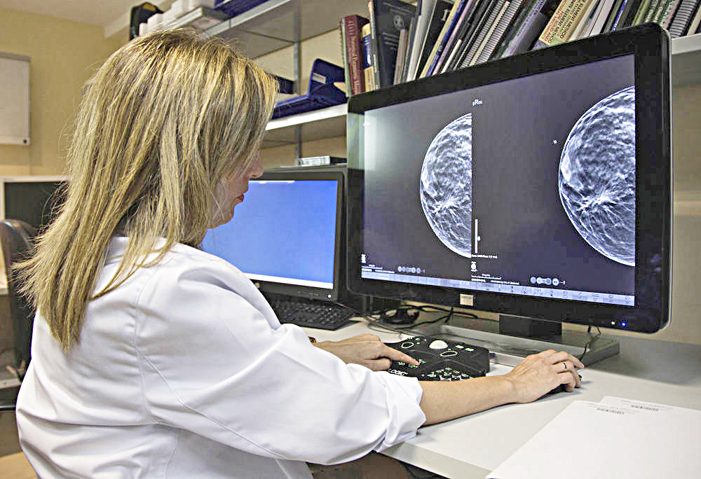 La edad y el grupo racial afectan la inteligencia artificial en los mamogramas digitales