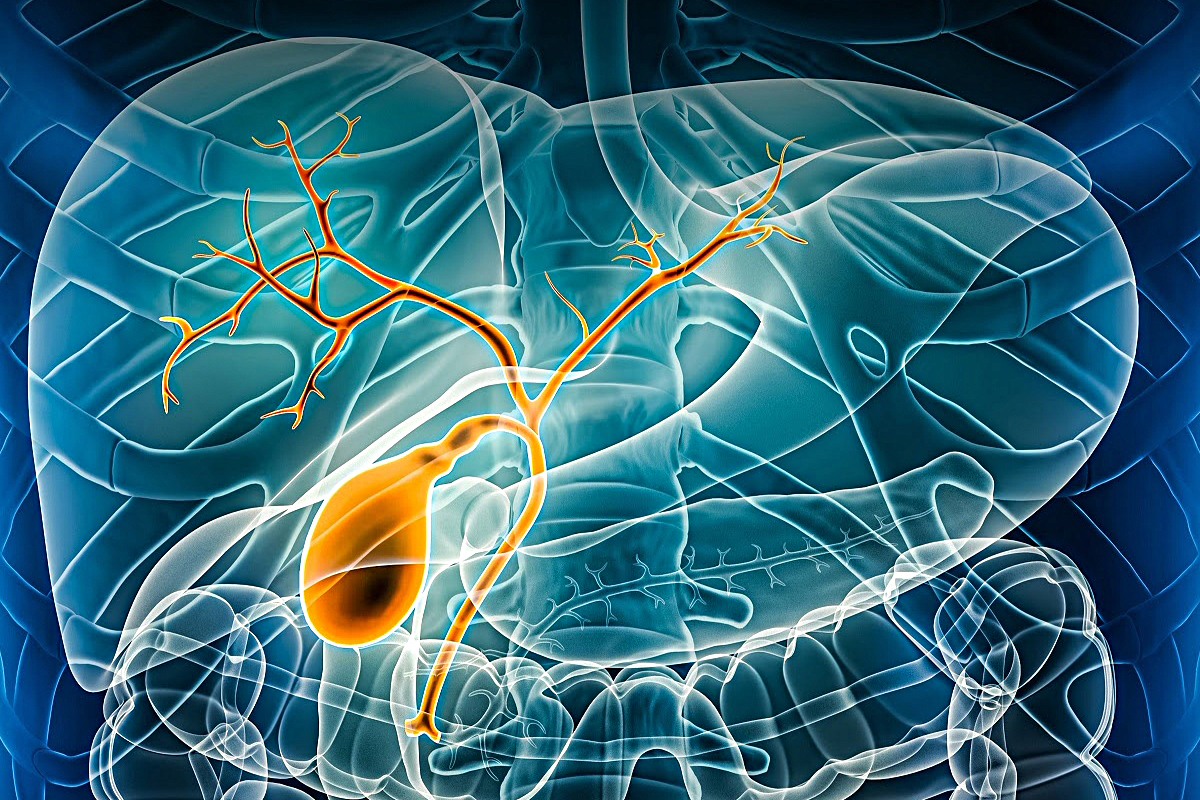 Colangiocarcinoma, una lucha silenciosa contra el cáncer de vías biliares