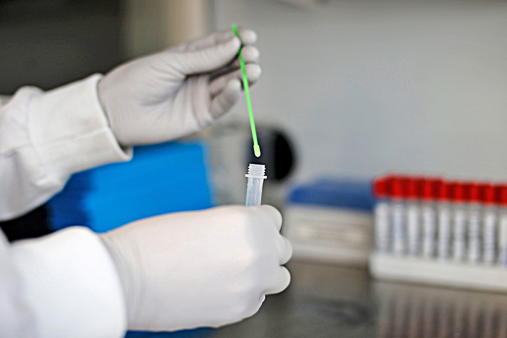 Enzimas bacterianas podrían combatir resistencia a los antibióticos