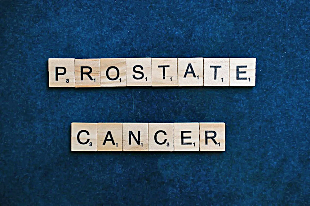 Bloqueadores de testosterona para cáncer de próstata provocan riesgos al corazón