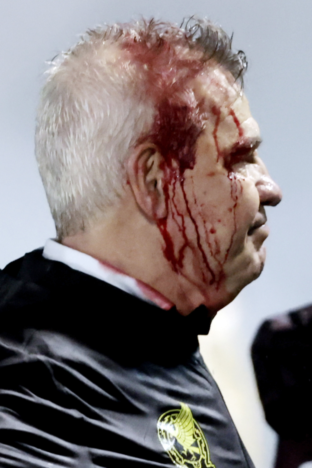 Infantino lamenta la agresión a Javier Aguirre: “No hay lugar para la violencia en el fútbol”