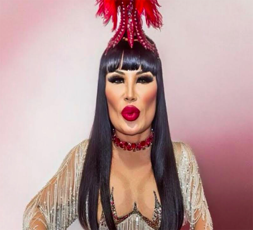 Lyn May estrena rostro: ¡luce irreconocible!