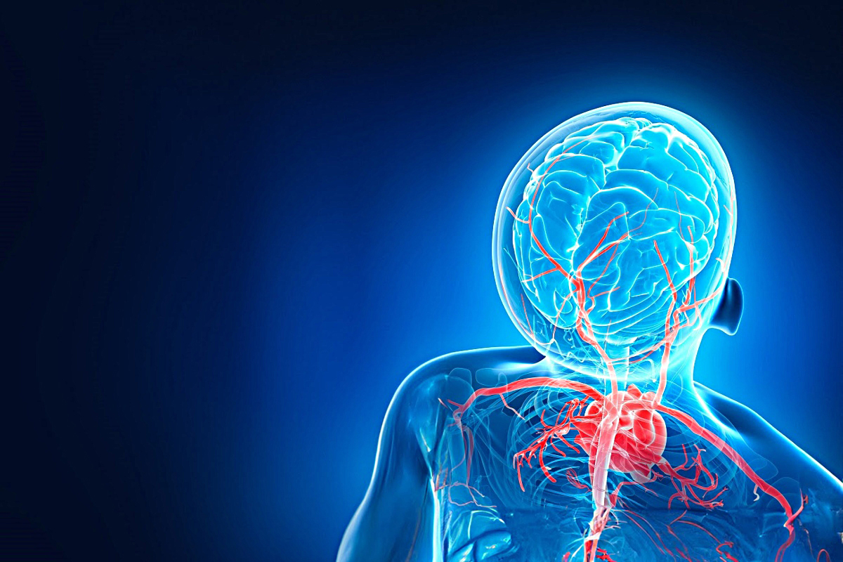 Un agujero en el corazón puede provocar accidentes cerebrovasculares en jóvenes