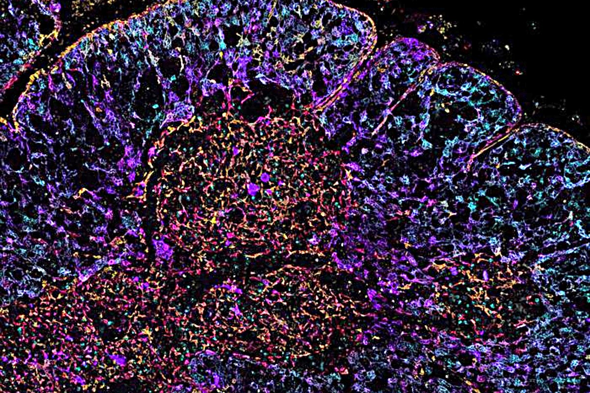 Crean el primer atlas espacial del timo humano para comprender la inmunidad de por vida