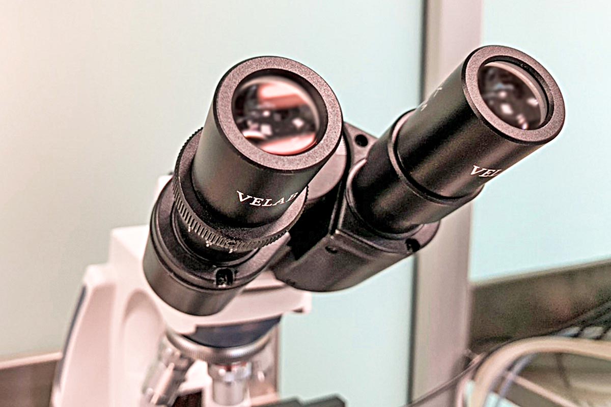 Descubren cómo las células del mieloma múltiple dañan los huesos