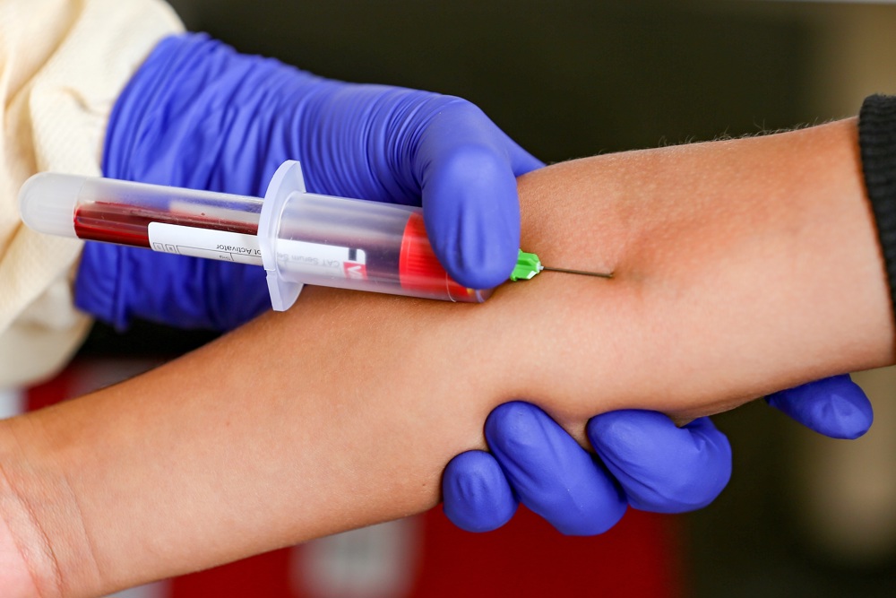 EE.UU. aprueba el primer test sanguíneo para ayudar en la detección del alzhéimer