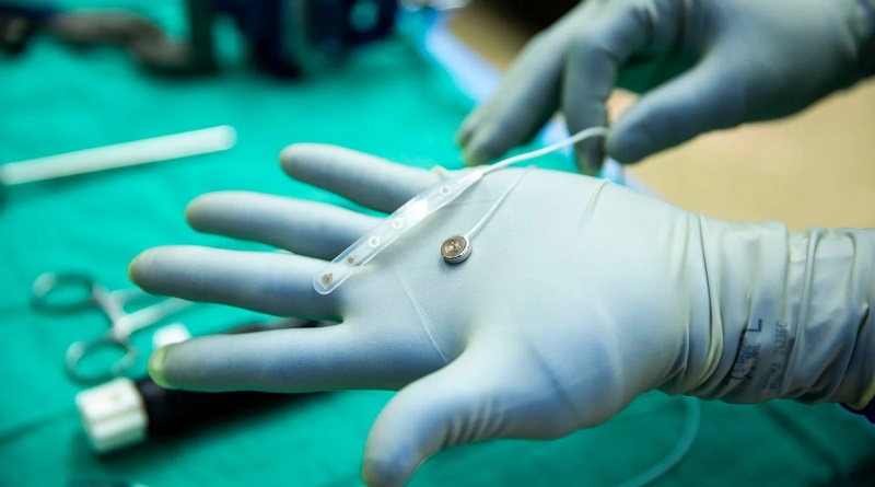 Un rival de Neuralink prueba un implante cerebral en un humano